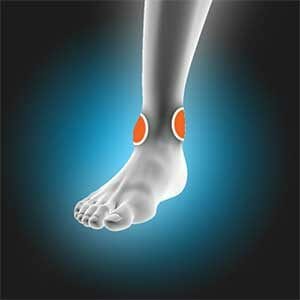 Ankle