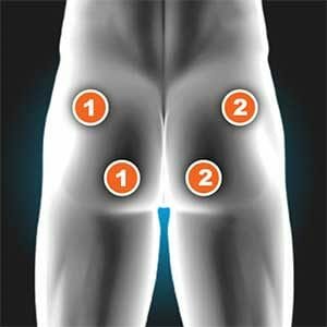 Gluteus Maximus