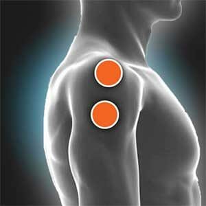 Lateral Deltoid