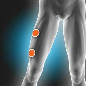 Vastus Lateralis