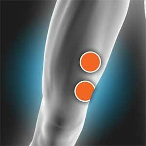 Vastus Medialis